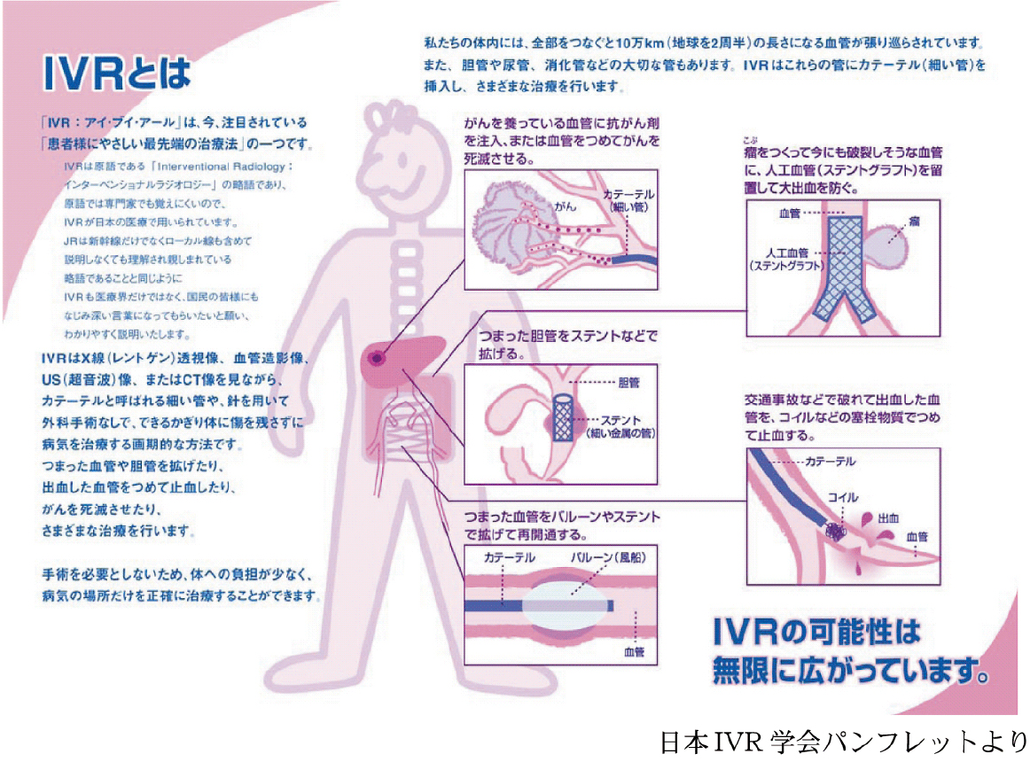 ipv とは 医療