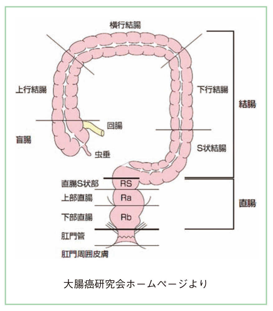 虫垂炎 急性