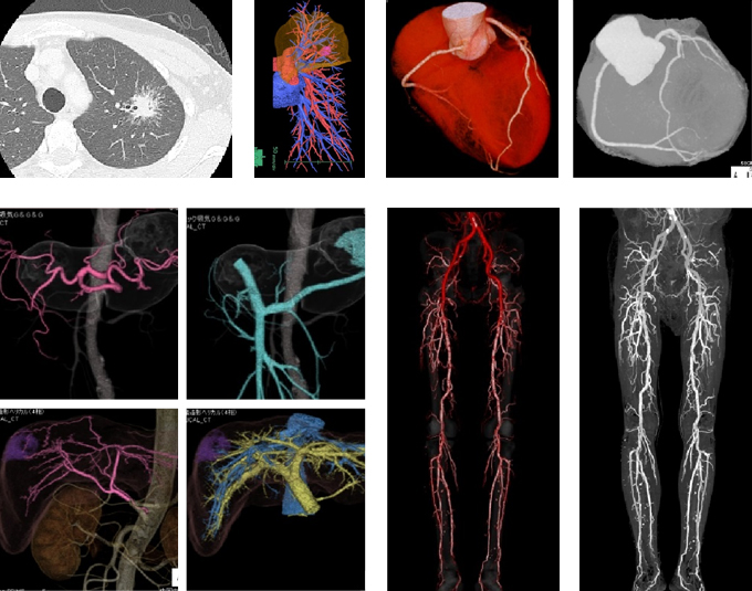 CTイメージ2
